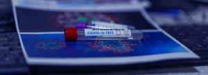 Restaurant Take Away Service during Coronavirus Outbreak