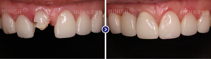 dental work in korea