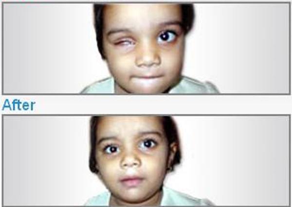 Shekhar Eye Research