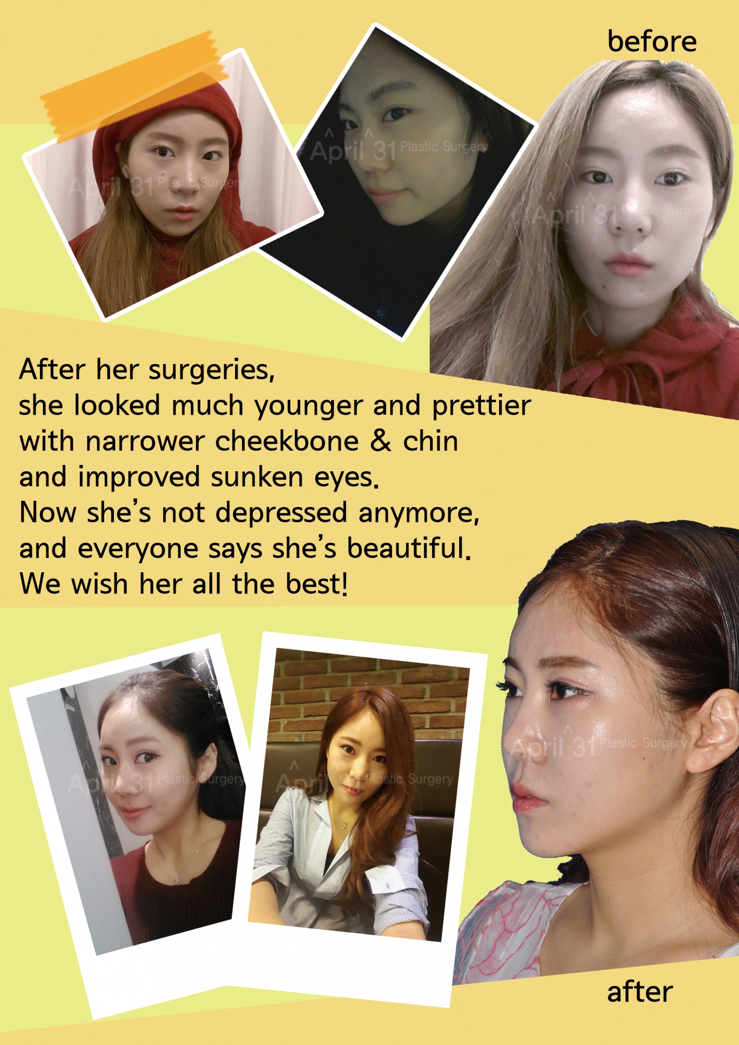 April 31 Plastic Surgery Clinic in Seoul