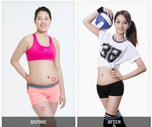 BANOBAGI Plastic Surgery