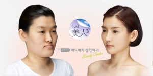BANOBAGI Plastic Surgery