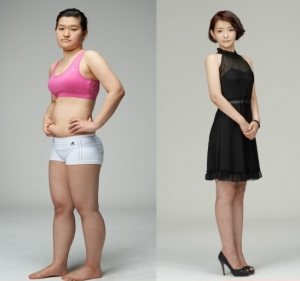 BANOBAGI Plastic Surgery
