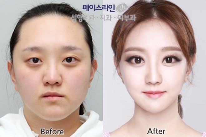 Faceline Plastic Surgery