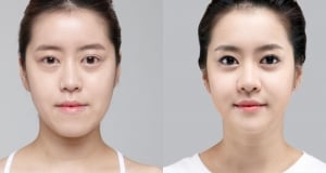 The Regen Plastic Surgery