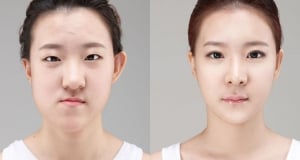 The Regen Plastic Surgery