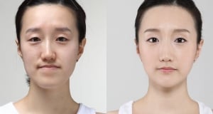 The Regen Plastic Surgery