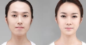 The Regen Plastic Surgery