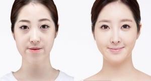 The Regen Plastic Surgery