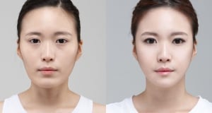 The Regen Plastic Surgery