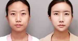 The Regen Plastic Surgery