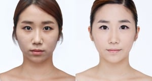 The Regen Plastic Surgery