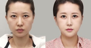 The Regen Plastic Surgery