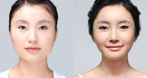 The Regen Plastic Surgery
