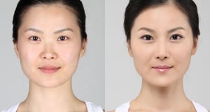 The Regen Plastic Surgery