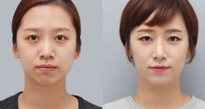 The Regen Plastic Surgery