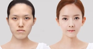 The Regen Plastic Surgery