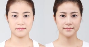 The Regen Plastic Surgery