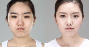 The Regen Plastic Surgery