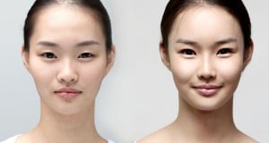 The Regen Plastic Surgery