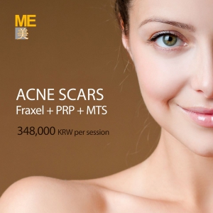 Introducing ME Clinic Acne scar care program