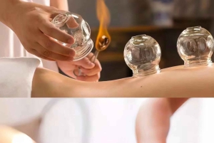 Shanghai: Kinesisk medisin, akupunktur og cupping-behandling