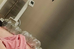 Shanghai: Kinesisk medisin, akupunktur og cupping-behandling