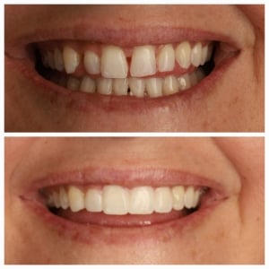 Clinica Dental Los Cristianos Smile