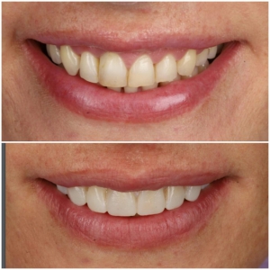 Clinica Dental Los Cristianos Smile